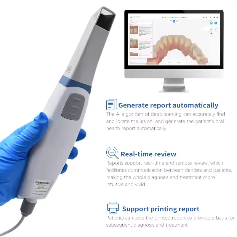 IOS 11 Portable Dental Intraoral Scanner 3d Dental 3d Digital Intraoral Scanner for Dental Teeth Treatment