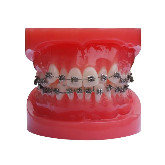Dental braces for teeth aligner adult typodont teeth orthodontic model trainer model for training teaching
