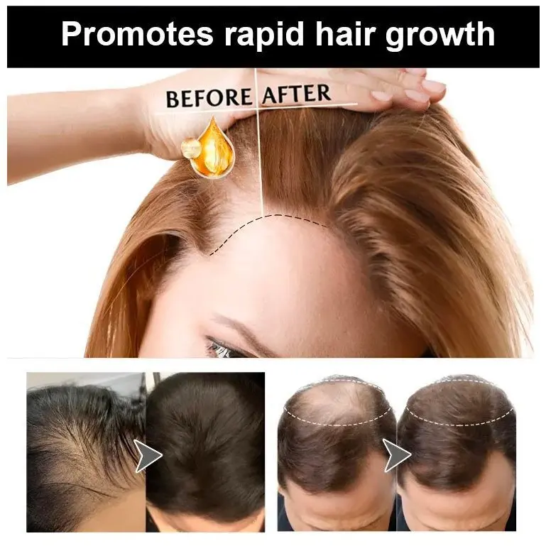 Professional Customization hair regrowth serum loss strengthen hair Powerful Oils Fast Thrive Hair Growth Power Mix Oil