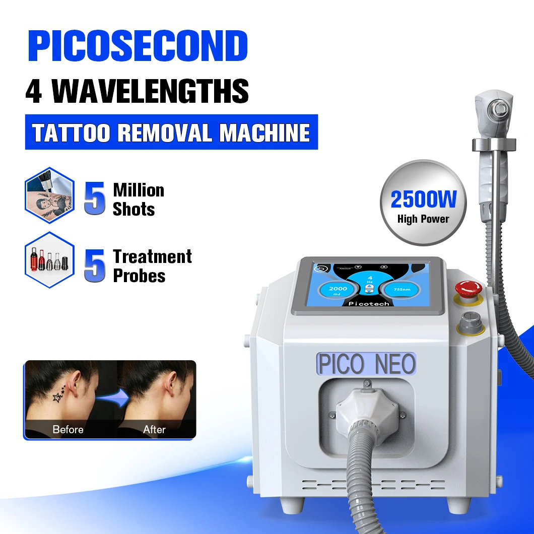 Portable Pico Laser Machine Tattoo Removal Picosecond Q-Switch Nd Yag Laser Tattoo Removal Laser Carbon Peeling Equipment