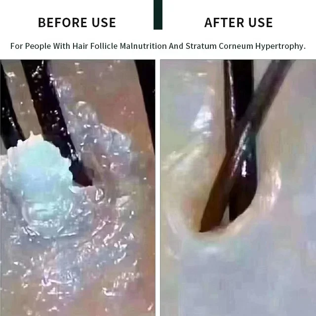 Средство для очищения кожи головы