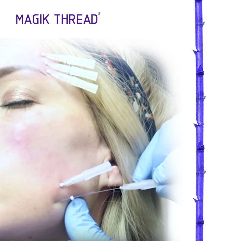 Magik Thread aesthetic products buy online cog 3-1 L blunt 19g 25mm nose thread mesh pro threads lifting