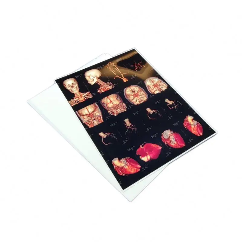 13X17inch Replacing Traditional Laser Film with High Definition and Low Price for Fuji Xerox Printer