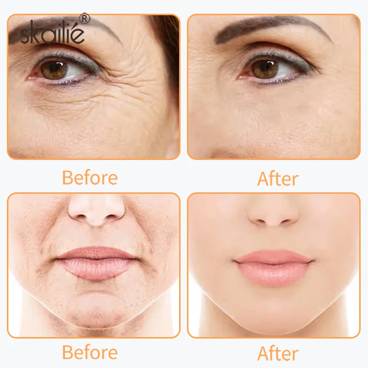 Custom Logo Private Label Anti Aging Retinol Face Cream Moisturizer Anti Age Face Firming Retinol Cream