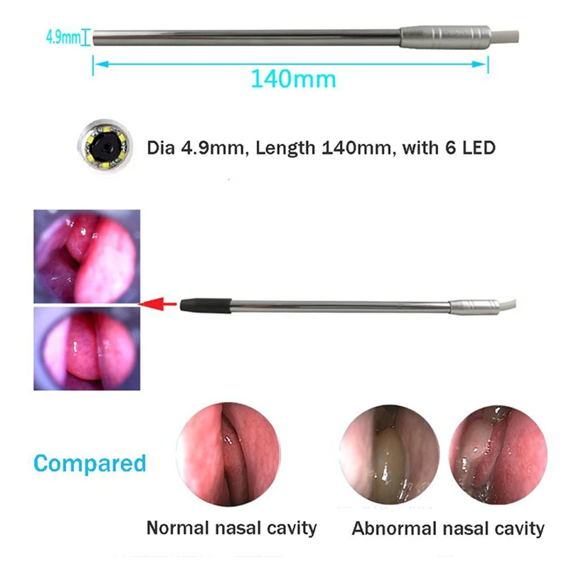 Medical USB Endoscope 4.9mm Lens for Ear Nose for OTG Android Phone PC Borescope Inspection Otoscope Endoscope Camera