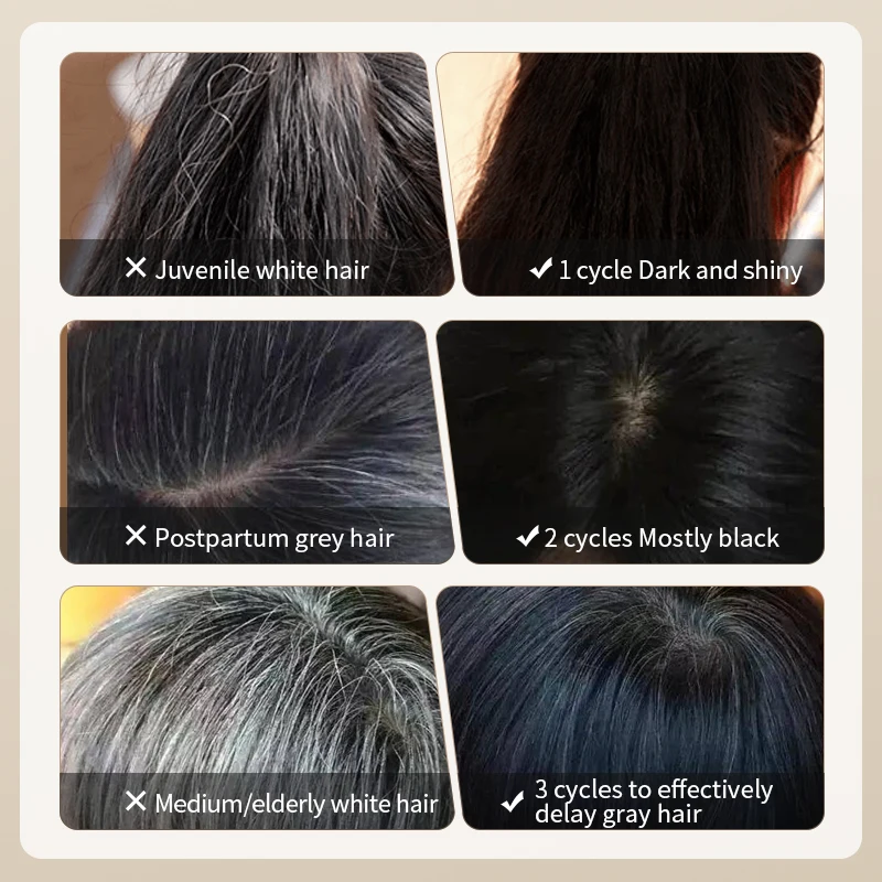 Wholesale Shampoo Nourish Scalp Black Reishi Polygonum Multiflorum Natural Anti Loss Black Hair Shampoo For Hair Growth Products