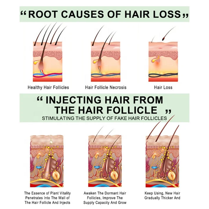 Rosemary Scalp Oil Organic Natural 7 Days Hair Tonic Free Hair Growth Oil for Alopecia Gallon Big Bottle Serum