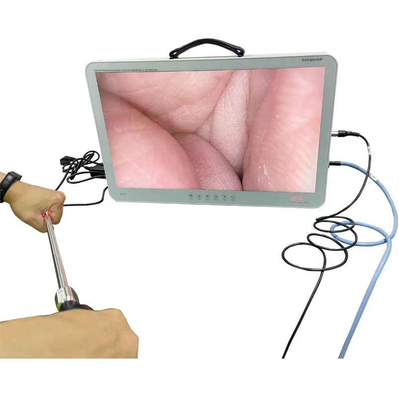 Portable FHD Endoscopo Camera  3-IN-1 FHD IMAGING SYSTEM
