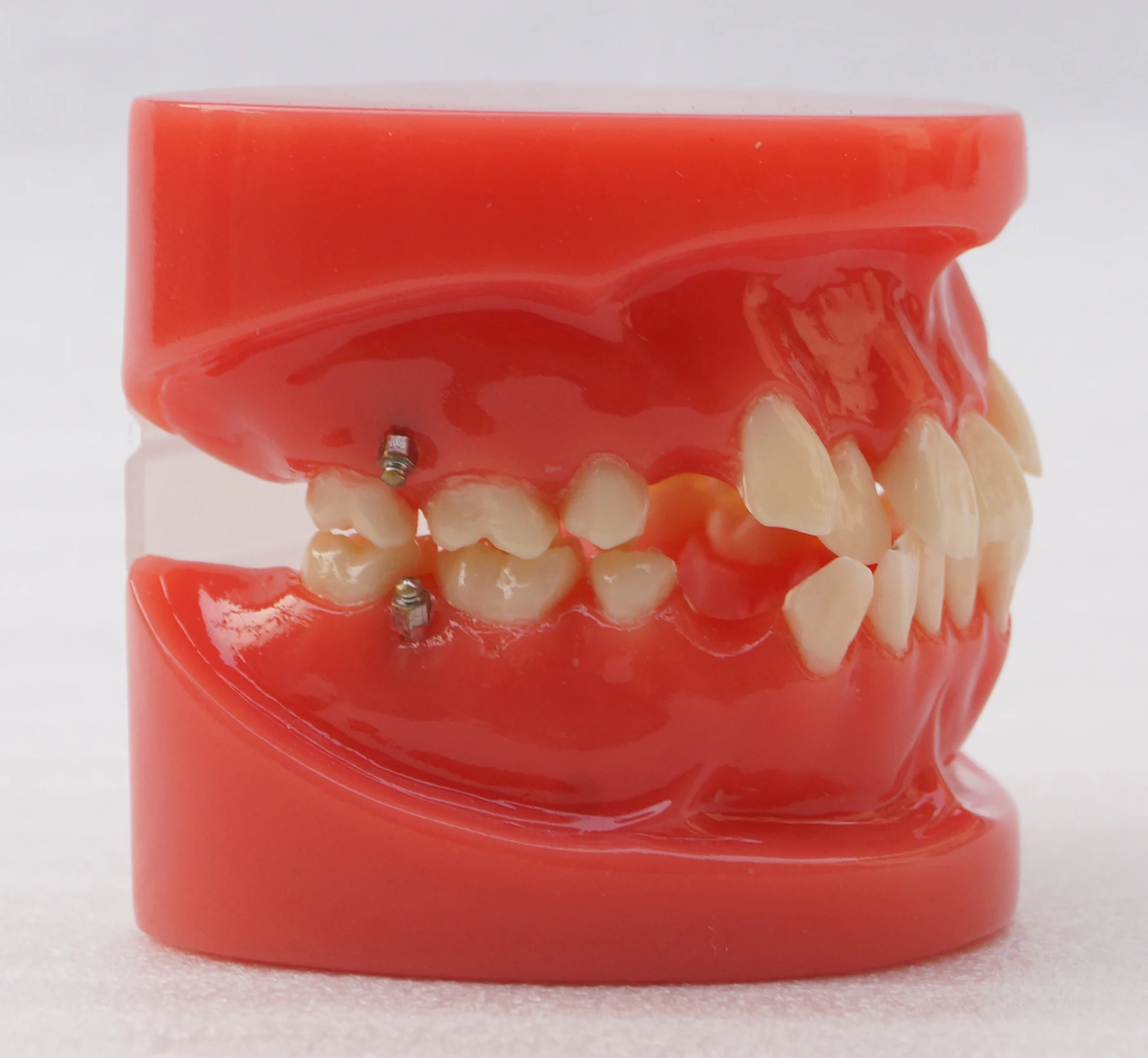 Dental Orthodontic Model 24Teeth Study Model