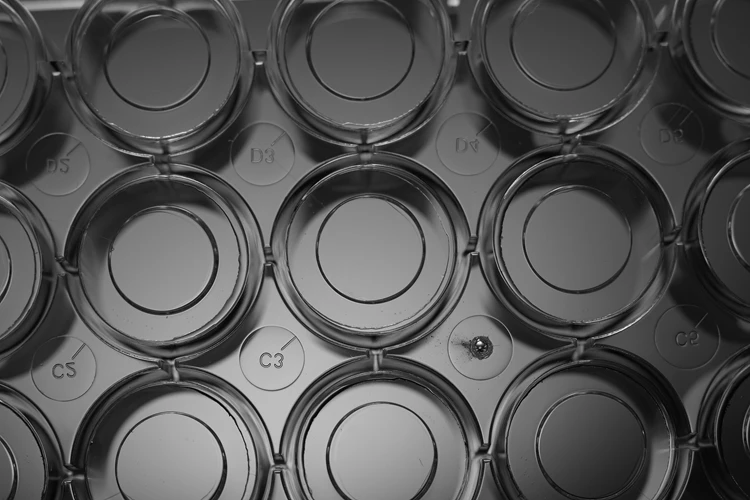 glass bottom cell culture dish