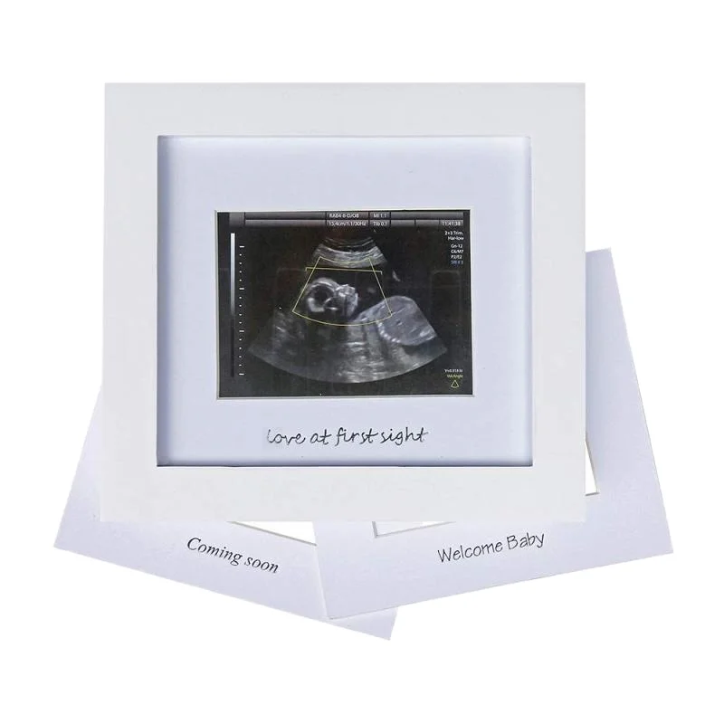OEM CUSTOM Pregnant woman B ultrasound photo frame, welcome baby paper photo frame hello little one newborn gift picture frame