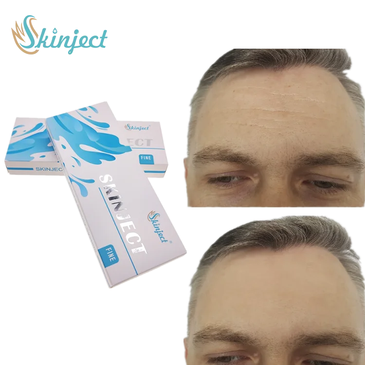 
Personal Used Skin Rejuvenation Chinese Factory Dermal Filler Placenta Injection 