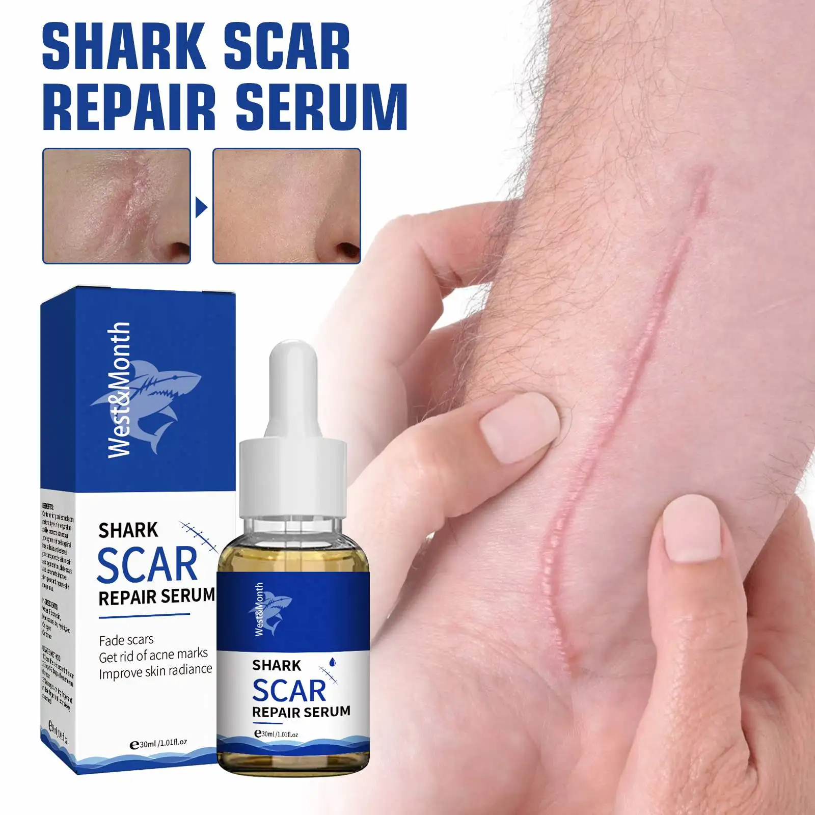 West Moon Wholesale Skin Care Scar Acne Mark Pimples Spots Repair Serum Shark Scar Treatment Oil Scar Removal Gel