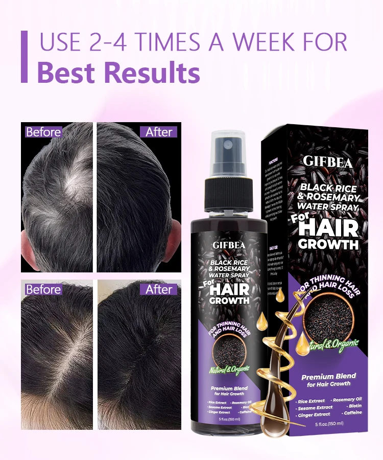 OEM caida de cabello hombre damaged hair repair rice water hair growth spray