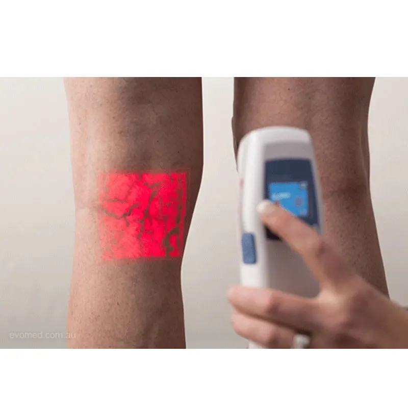 Hospital Pediatric Blood Vessel Locator Medical Accu vein AV300 Infrared Vein Finder