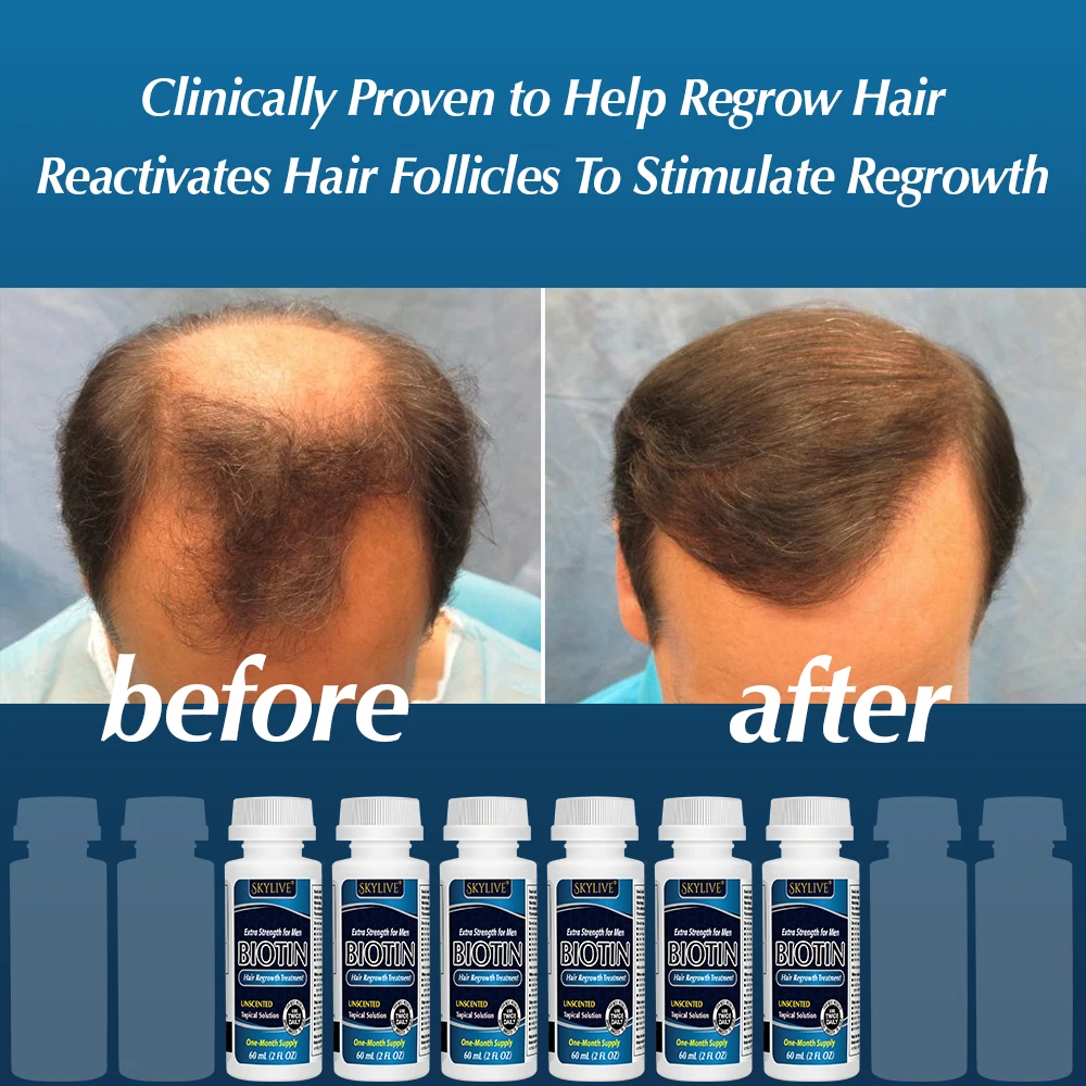 Biotin Hair Growth Serum For Anti Loss Essential Oil Products Fast Treatment Prevent Thinning Dry Frizzy Repair Private Label