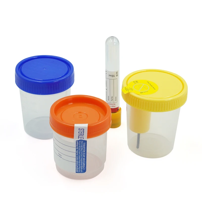 Disposable Urine Container Urine Sample Cup Vacuum Urine Container With Needle