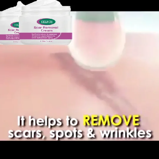 Amazon hot selling acne scar treatment ointment scar removal cream for surgical acne  scald scar
