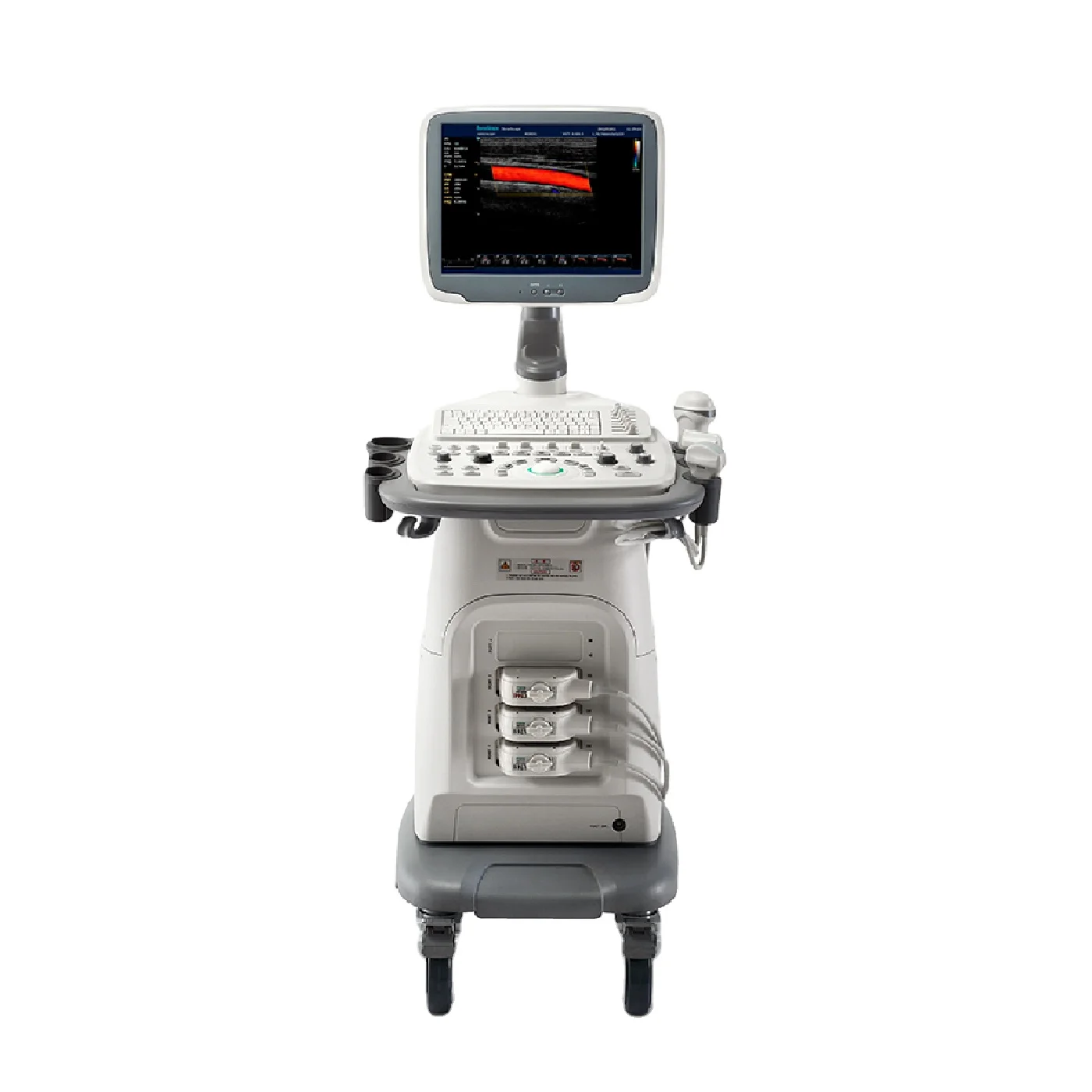 Sonoscape S11 Trolley Color Doppler UltrasoundUSG Gynecology Urology MSK 15 inch Display