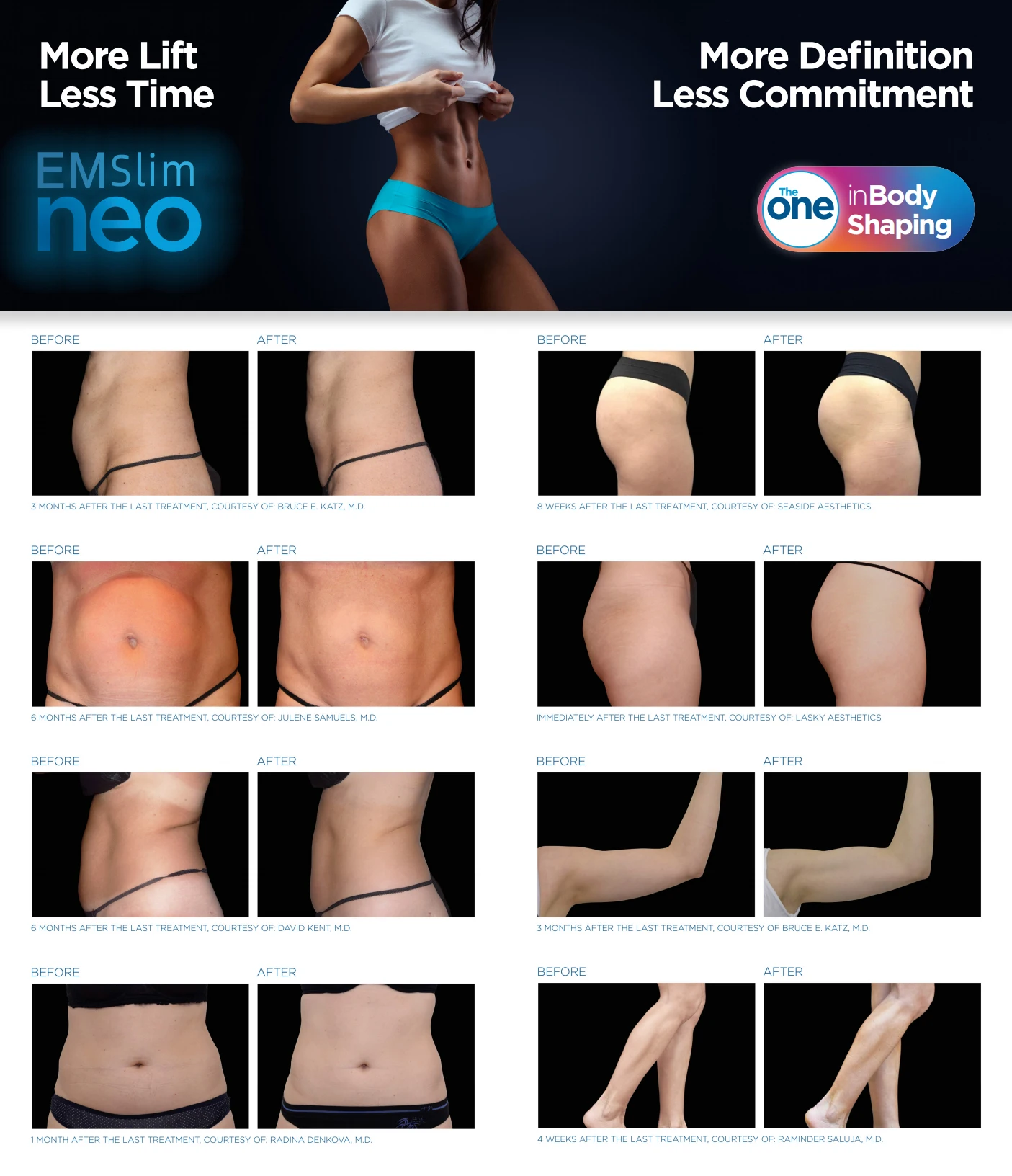 2022 Best sell 4 Handle reduce weight Body Sculpt Emslim Neo Em RF Slim Machine