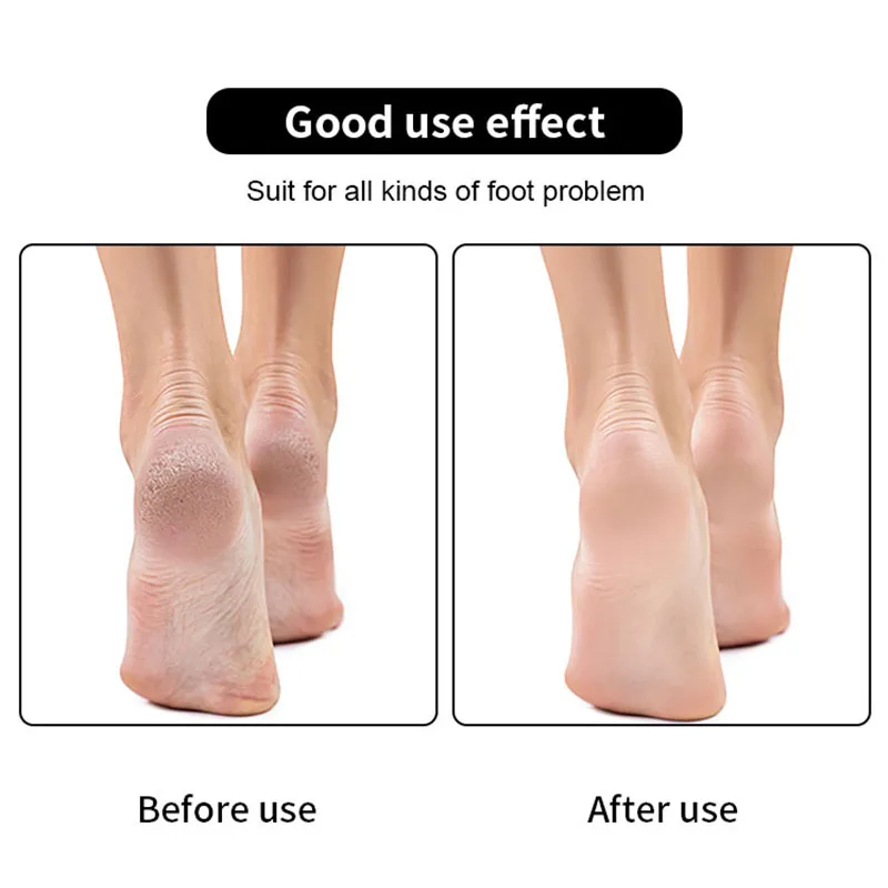 Best feet care pedicure tool plastic handle stainless steel callus remover foot file scraper for remove hard deap skin