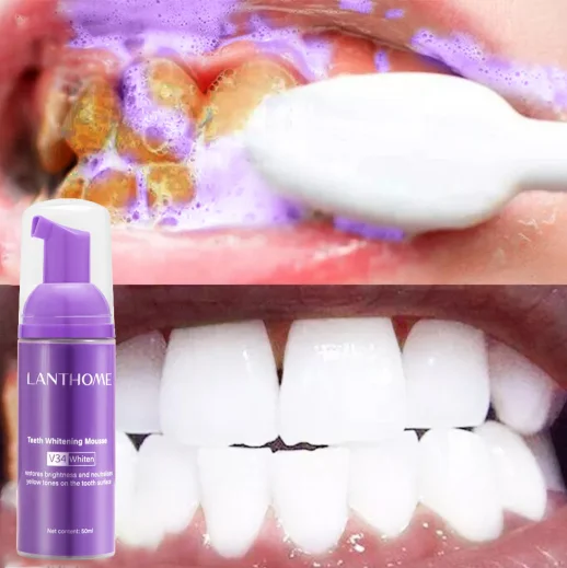 Lanthome Wholesale Teeth Whitening Mousse Dental Oral Hygiene Effective Remove Stains Plaque Gel Teeth Cleaning Essence