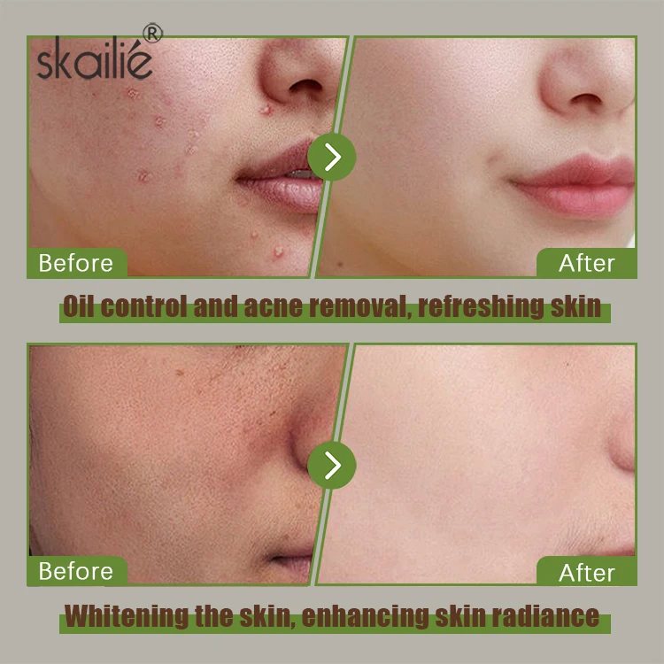 Private Label Custom Logo Natural Beauty Organic Facial Care Whitening Exfoliating Vitamin C Turmeric Clay Mask