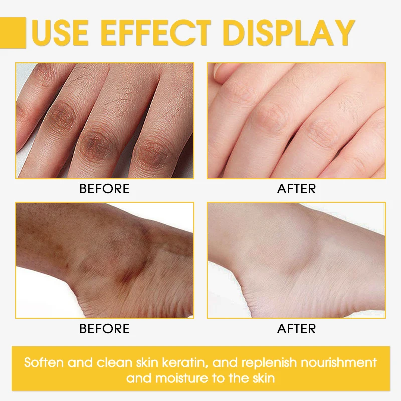 Extra Whitening Yellow Peeling Oil Skin Revitalizer Firming and Organic Lactic Acid Peeling Oil for Dark Knuckles in Ghana
