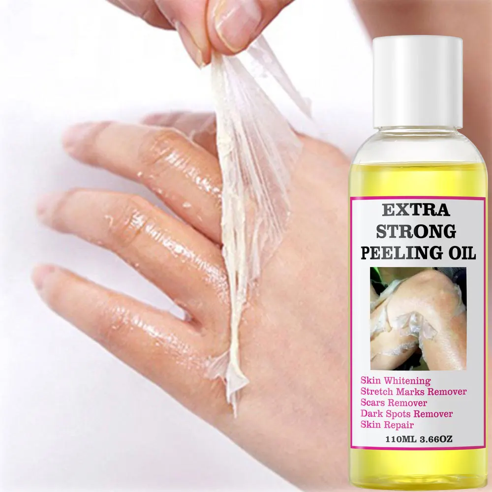 Custom Logo Private Label Body Care Dark knuckle Scars Extra Strong Peeling Oil Dark Spot Remover Whitening Yellow Peeling Oil