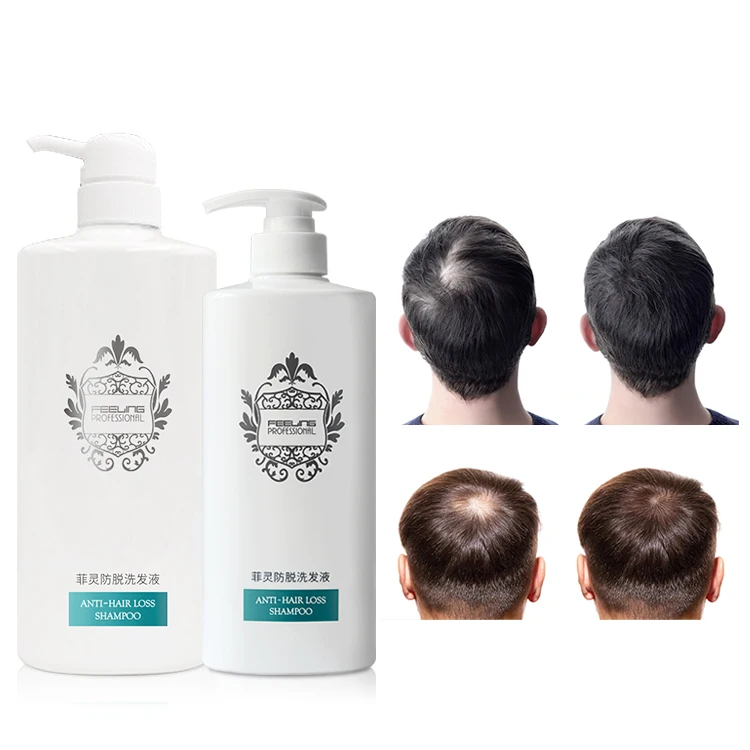 OEM Pro Hair-Anti Hairloss Shampoo 1000ml TCM Ingredients Silicone-Free Chinese Government Certificate