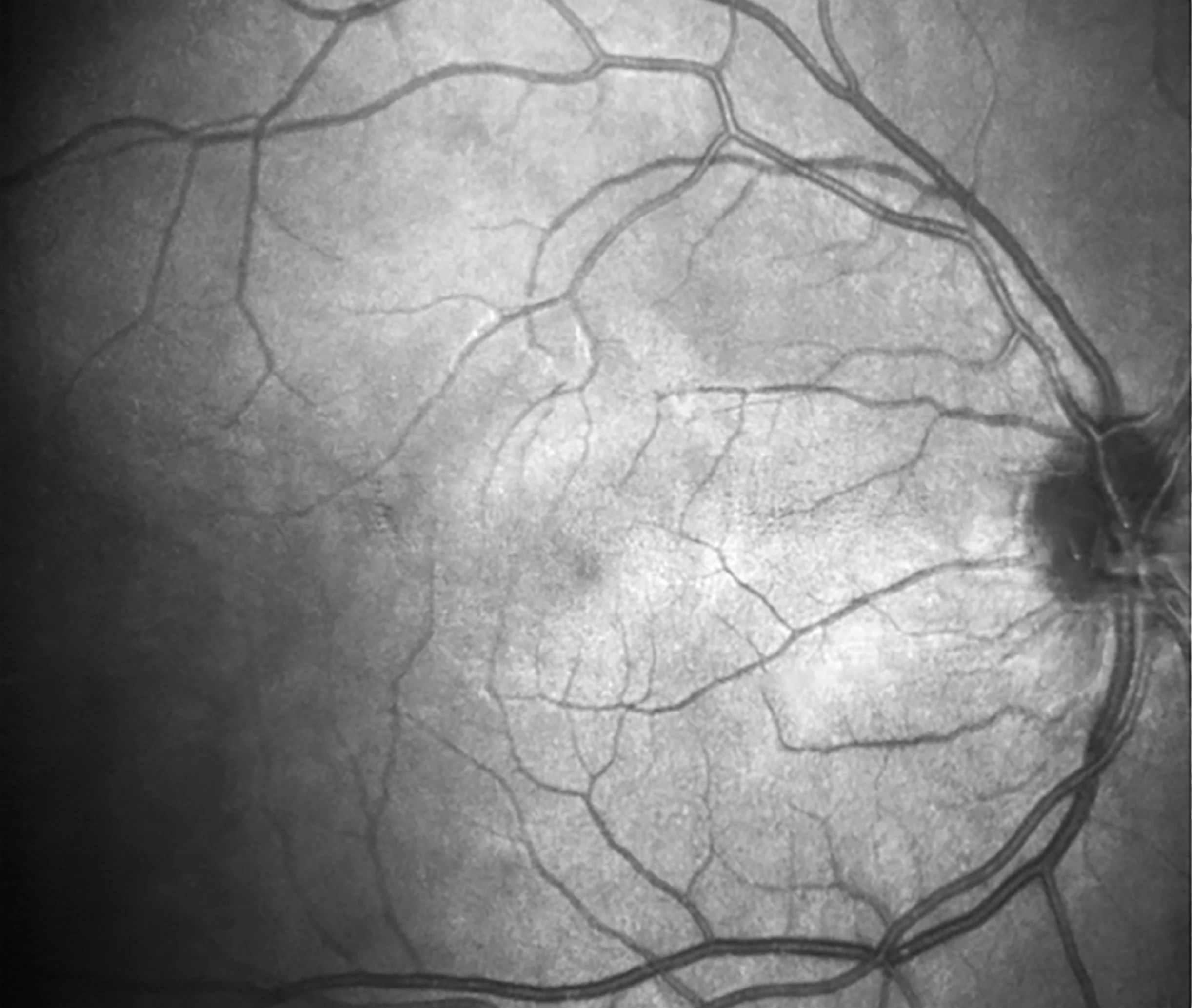 Latest  Optical Coherence Tomography Scanner Eye Examination Ophthalmic Optical Equipments fundus camera