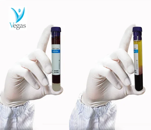 China Factory Glass 15ml PRP kit  with 2 PRP tubes