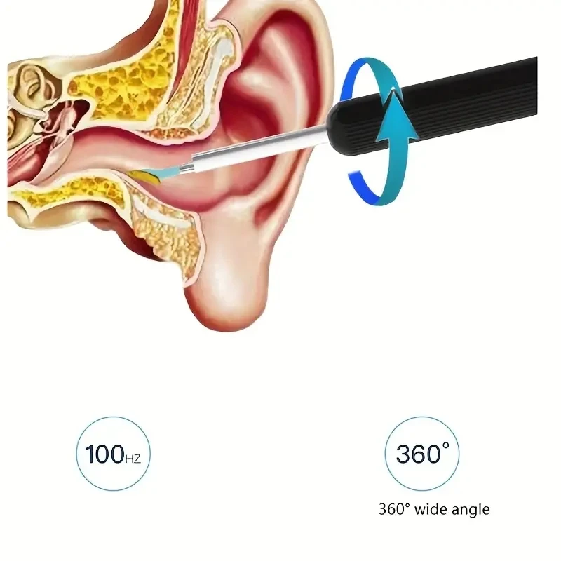 Камера для чистки ушей с 1080HD комплект удаления ушной серы 8 инструментами очистки камеры со светодиодной подсветкой