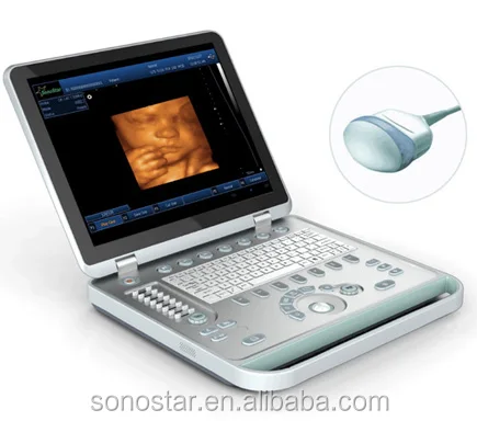 
Hot Selling 4D Portable Ultrasound Machine Price For Pregnancy Bady Monitor 