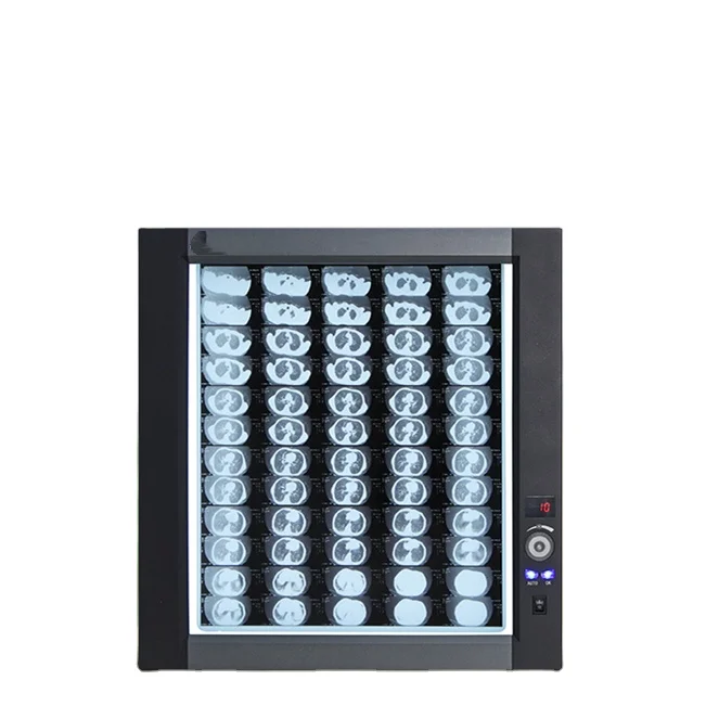CE Medical Single/ONE LED Negatoscope X-ray Film Viewer Box ndt film viewer