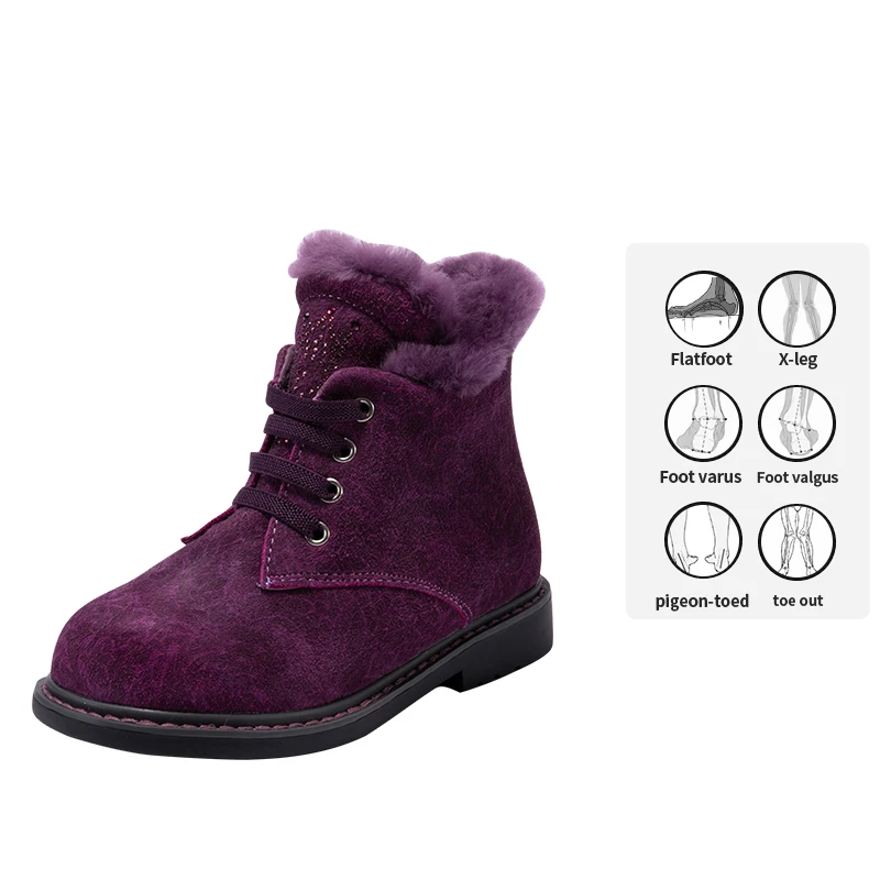 Princepard Customized Accept Side Zipper Anti Slippery Fur Insole Kid Shoes Girl Orthopedic Boots