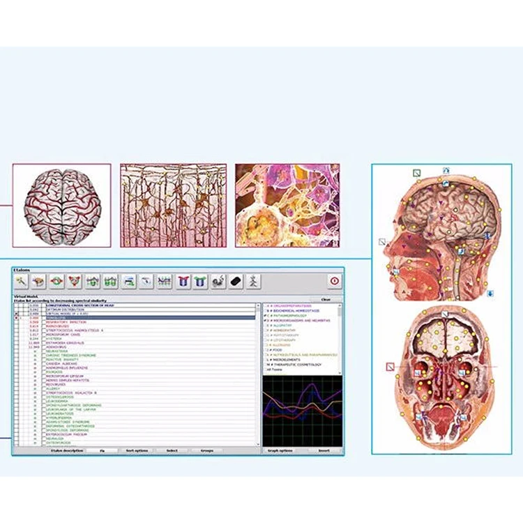 SSCH/Suyzeko Biofeedback 25d nls body health analyzer Bioresonance Metapathia GR 4025 Metatron NLS