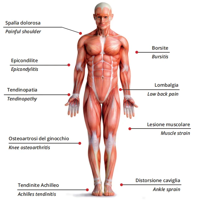 60w High Intensity Physical Laser Therapy Pain Relief Diode Laser 980nm Class 4 Laser Physiotherapy Machine