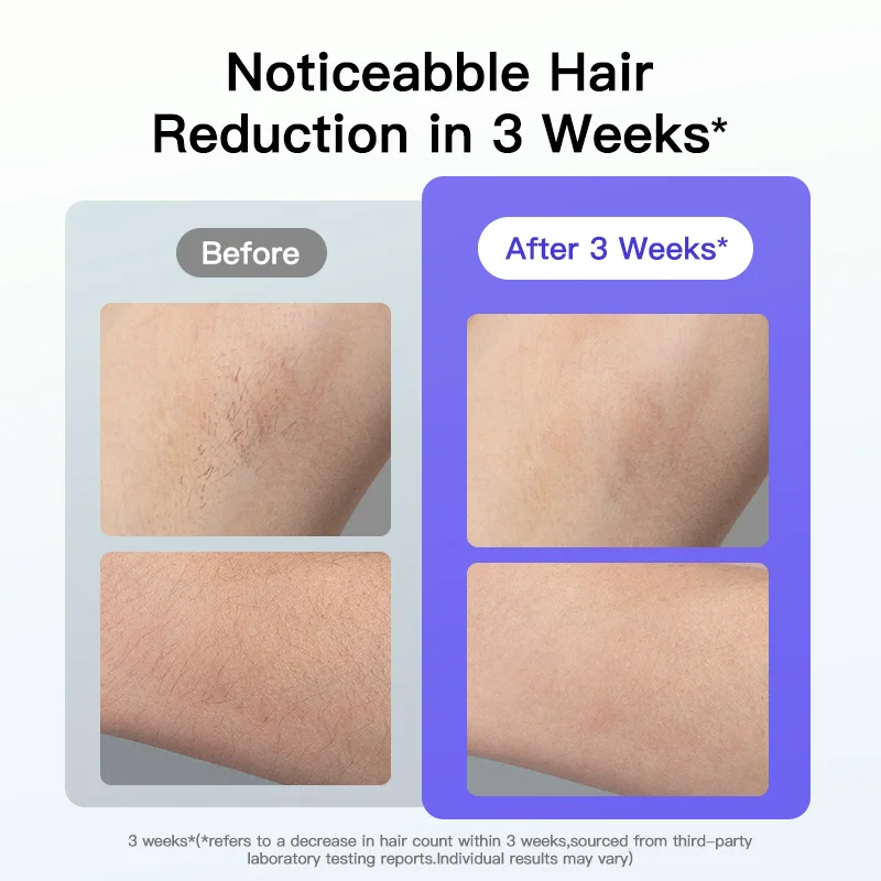 Best Seller Home Use Ice Cooling Remover Ipl Portable Handle Epilator Woman Laser Light Hair Removal Device Machine