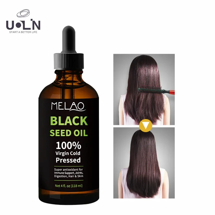 100% Pure Organic Black Seed Essential Oil Natural Cold Pressed Softgels Skin Hair Care Body Massage Oil For Hair