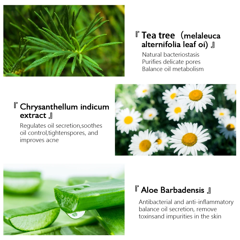 VIBRANT GLAMOUR Acne Treatment Shrink Pore Face Cleansing Foam Oil Control Brightening Pimple Clear Herbal Acne Facial Cleanser