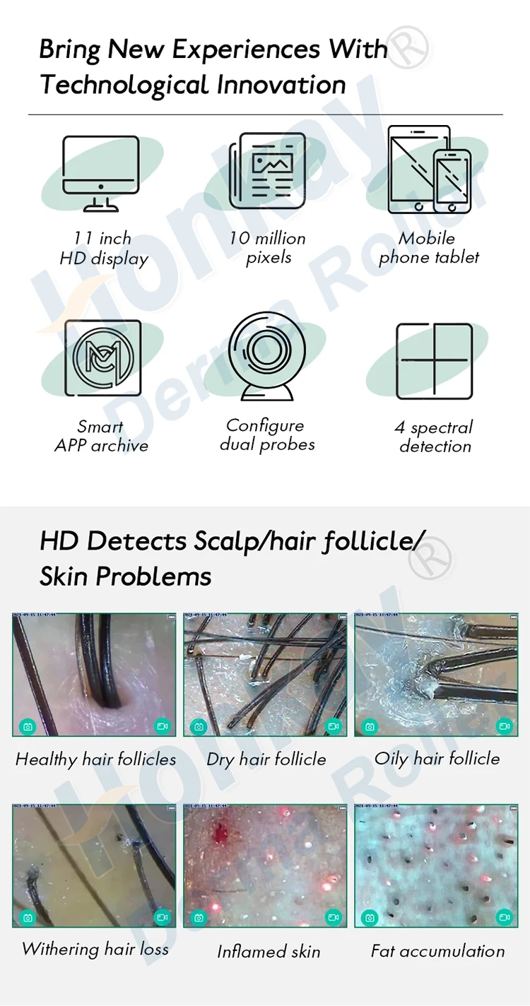 Honkay USB Scalp Analyzer Scanner Machine Home Use Hair Follicle and Scalp Analyzer Equipment USB Plug US/UK Type