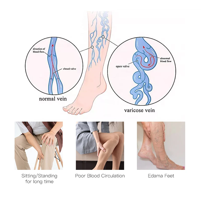 For the treatment of phlebitis 20-30mmhg medical grade pregnancy varicose veins compression stockings thigh high wrap toe