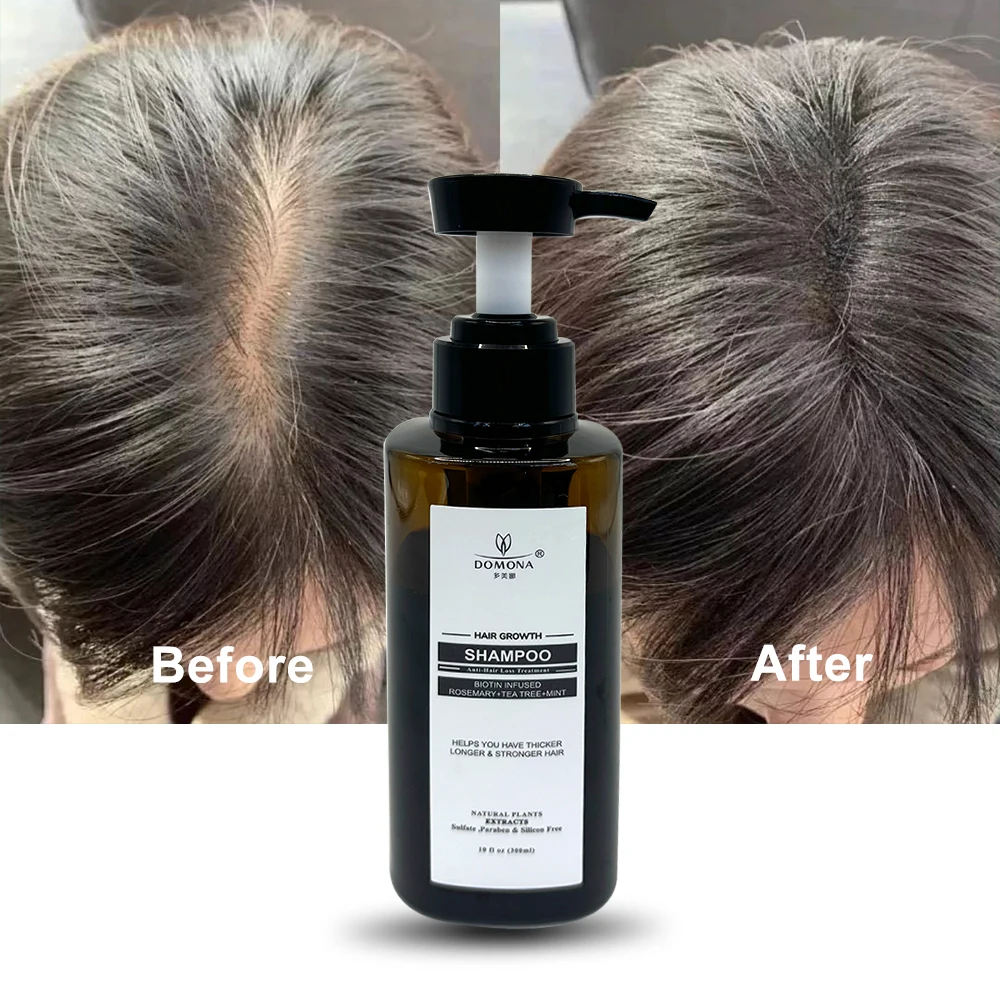 Hair Spa Ginseng Mint Hair Regrowth Scalp Treatments Shampoo Conditioner Serum Oil For Bald Hair Women And Men