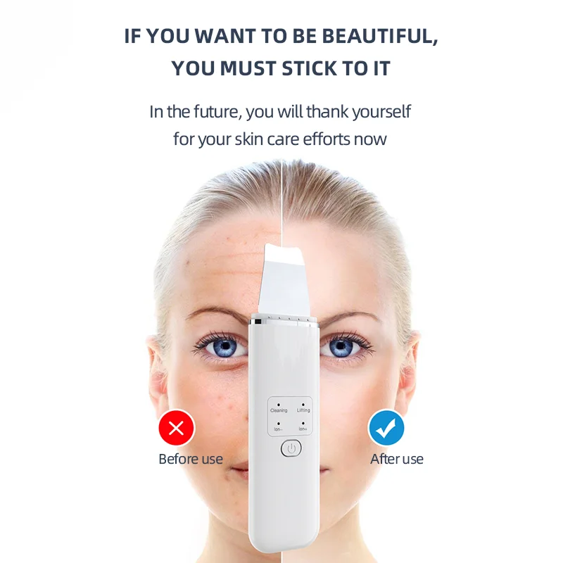Skin scrubber professional vibration silicone face skin spatula blackhead remover facial scrubber