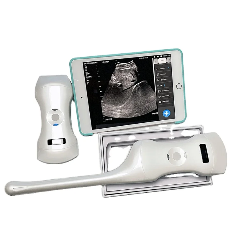 192 Element Human Scanner Instruments Handheld Device Portable Touch Wireless Ultrasound Medical Machine Equipment