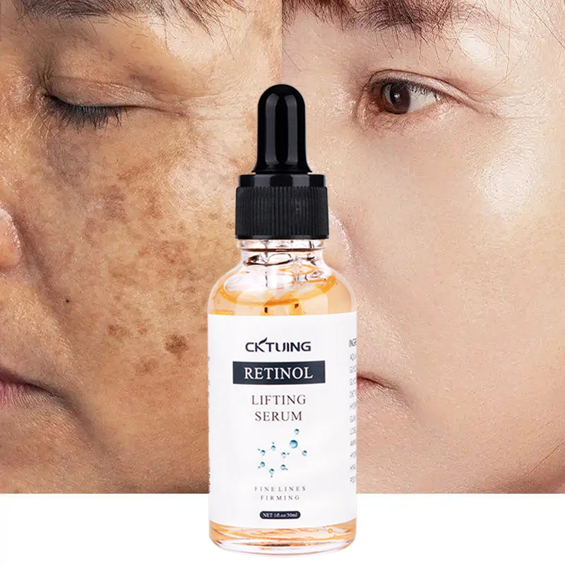 Free Sample OEM Retinol face skin care serum organic natural Anti Aging Dark Spot Remover Brighten And Whitening facial serum