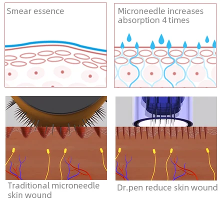 
Dr Pen Derma Roller Doctor Pen Microneedling Dr Pen A7 Cartridge 