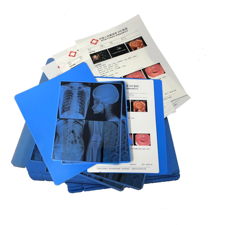 Inkjet Medical Printing Blue Film PET for Hospital X ray
