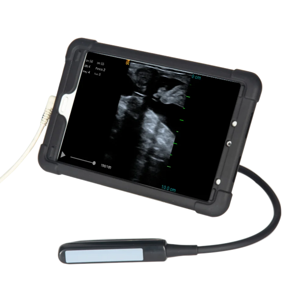 Hot-sale horse cattle vet ultrasound machine Wireless BestScan S5 Plus color Doppler portable ultrasound scanner system
